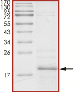 Alpha-synuclein, PLK2-phosphorylated